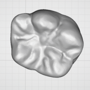 3D Molar Tooth Model